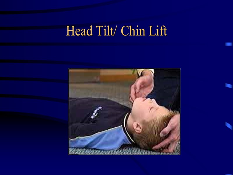 Head Tilt/ Chin Lift